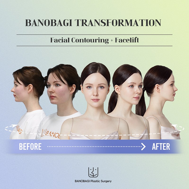 Face contour & Facelift Real Review
